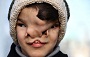 كودك عجيب الخلقه تربت جامي + تصاوير