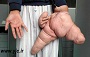 5 مشکل ژنتیکی باونکردنی در دنیا +عکس