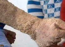 کودکی که به جای پوست فلس دارد! + تصاویر