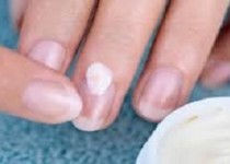 هشدار متخصصین نسبت به خطرات و عوارض کاشت ناخن
