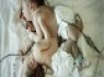 دوقلوهای به‌هم‌چسبیده جدا شدند +تصاویر