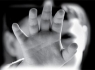دستگیری مادر بی رحم و ناپدری معتاد به جرم کودک آزاری