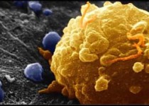 طلا درمانی برای مهار سرطان‌های مرگبار