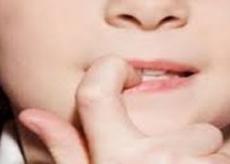 اضطراب در کودکان مهمترین علت جویدن ناخن است