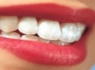 ابداع روشی نوین برای پیشگیری از پوسیدگی دندان