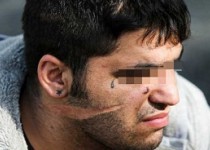 خودزنی شرور نیمه عریان در ملاء عام
