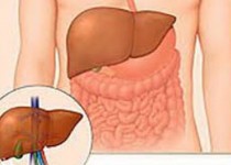 سن ابتلا به کبد چرب به زیر 40 سال رسید