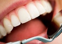 زیبایی دندانتان با این خوراکی ها