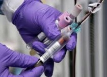 آزمایش‌هایی که همه‌ی خانم‌ها باید انجام دهند