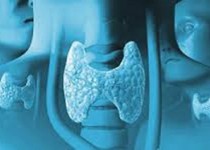 نشانه های تشخیص سرطان تیروئید