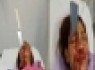 نجات معجزه آسا زنی با یک چاقو در پیشانی +عکس