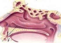 اگر حس بويايي تان خراب شده خطر مرگ در كمينتان است