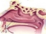 اگر حس بويايي تان خراب شده خطر مرگ در كمينتان است