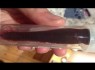 زالو در بینی این زن گرفتار شده بود + تصاویر