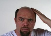 ریزش موی شما نشانه این بیماری است