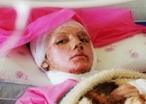 ورود کمیسیون شوراها و امور داخلی مجلس به مسئله "اسیدپاشی در اصفهان"