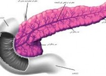 منشاء اصلی سرطان لوزالمعده