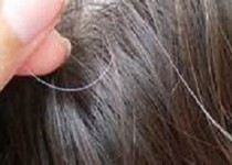 کم خونی یکی از علت های اصلی سفید شدن موها