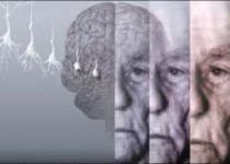 حسود و موذی هستید؟ آلزایمر می گیرید