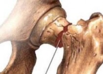 با بلند کردن اشیاء‌ استخوانهایتان پوک می‌شود