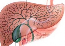 سنگ کیسه صفرا این افراد را تهدید می‌کند