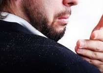 با شوره سر چه کنیم؟