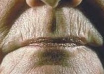 برنزه کردن شما را 20 سال پیرتر می‌کند