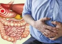 علایم سرطان معده را بشناسید