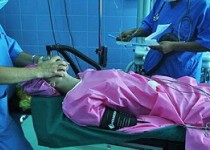 چینی‌ها به سراغ خطرناک‌ترین جراحی زیبایی دنیا می‌روند