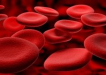 با چه مواد غذایی از کم خونی خود جلوگیری کنیم؟