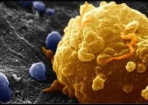 ۱۵ نشانه سرطان برای مردان