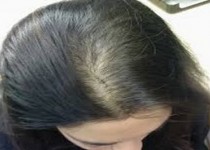 اگر موهای پرپشتی می خواهید این گیاهان را بخورید!