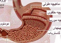 درد و سوزش معده‌ خود را جدی بگیرید