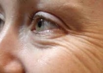 چروک صورتتان را با این روشها اتو کنید