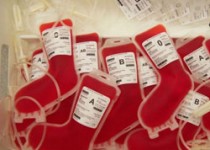 رابطه گروه های خونی و آلزایمر