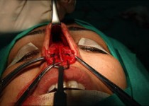 عمده‌ترین انگیزه زنان متأهل برای عمل زیبایی