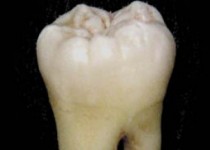 این میوه لذیذ به رایگان دندانهایتان را بیلیچینگ می‌کند