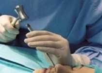 مرگ دختر ۲۱ ساله هنگام عمل جراحی زیبایی