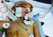 شکنجه یک کودک 9 ساله