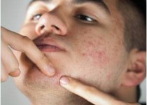 استفاده از کرم های آرایشی بدون تجویز پزشک معالج ممنوع است