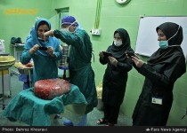 کیست ۱۸ کیلویی در بدن یک زن ایرانی