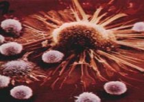 ارتباط یک ویروس با سرطان سینه