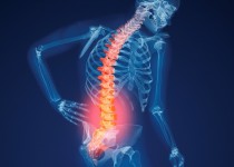 پوکی استخوان بیماری خاموش استخوان ها/ زنان 4 برابر مردان به این بیماری مبتلا می شوند