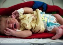 از کم شنوایی نوزادن تا رکوردداری سیستان و بلوچستان در ناشنوایی