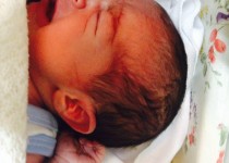 کودکی که باچشم از حدقه بیرون زده متولد شد فردا مرخص می شود + تصاویر