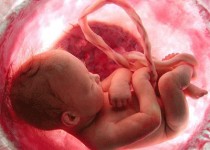 بیماری‌های ژنتیکی سومین عامل مرگ و میر کودکان در سیستان و بلوچستان/  خطر کمبود ید را جدی بگیریم