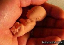 پیش فروش جنین چندماهه 2 میلیون تومان!