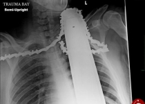 وحشتناک ترین عکس های رادیولوژی از بدن انسان+ تصاویر