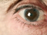 با نگاهی دقیق به چشمانتان از سرطان جلوگیری کنید