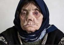 مرگ در راه ناگفته هایی هولناک از بیماران جذامی/ جذامی‌ها کجای ایران زندگی می‌کنند؟(+18) / چالش مچ دست در پرسپولیس